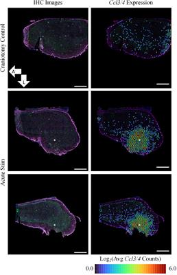 Spatial Transcriptomics as a Novel Approach to Redefine Electrical Stimulation Safety